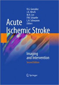 Image of Acute ischemic stroke: imaging and intervention