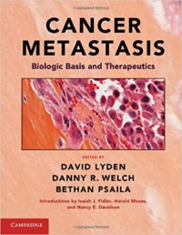 Image of Cancer metastasis: biologic basis and therapeutics